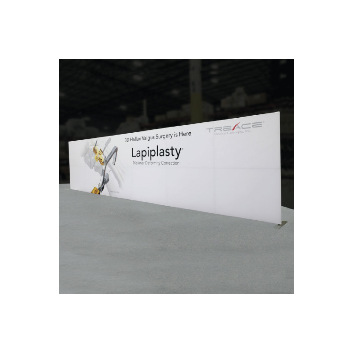 Large trade show backdrop display promoting Lapiplasty 3D Hallux Valgus surgery for medical exhibitions and events